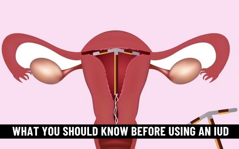 What You Should Know Before Using an Intrauterine Device (IUD)